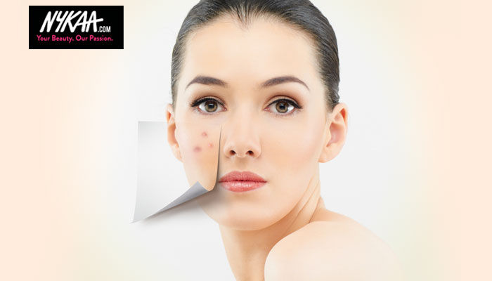 HOW TO COVER ACNE SCARS WITH MAKEUP LIKE A PRO