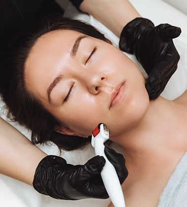 how to cure pimples- rolling