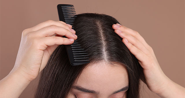 Effective Treatment For Oily Scalp, Causes & Best Products