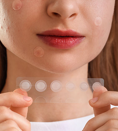 how to remove pimple in one night with bandage