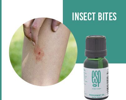 Summer Skin Care Tips- Insect Bites