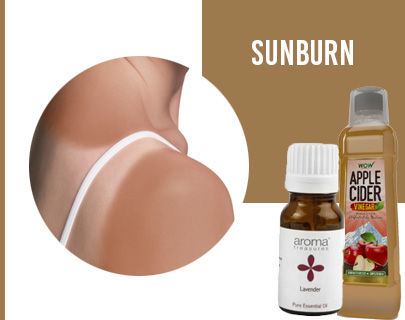 Summer Skin Care Tips- Insect Bites