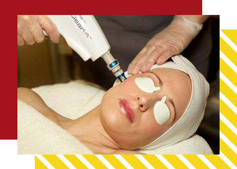 bride skin care treatment – clearlift laser treatment