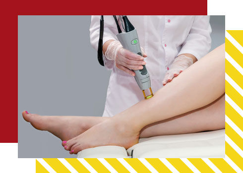 bride skin care treatment – laser hair removal