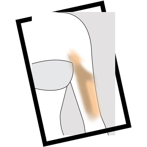 Your Ultimate Body Contouring Guide - 3