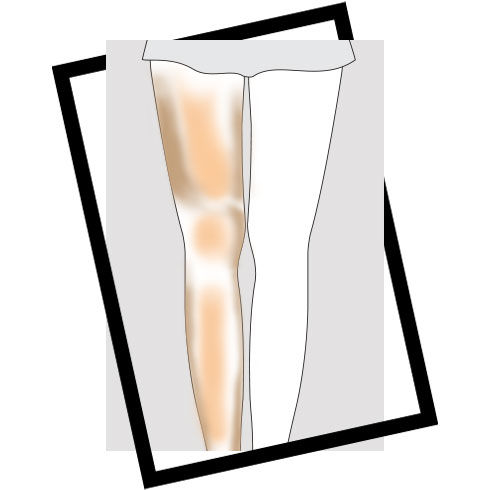 Your Ultimate Body Contouring Guide - 5