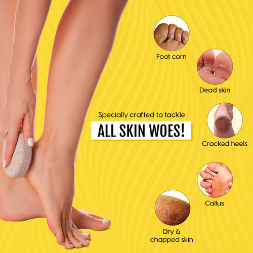 Buy Matra Pumice Stone 40mm (Color May Vary) Pack of Online