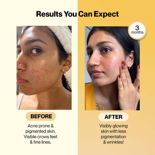 Buy Setu Skin Glow & Youth Combo, Setu Glutathione Fizz Tablets + Collagen with Ceramosides (30 days) Online