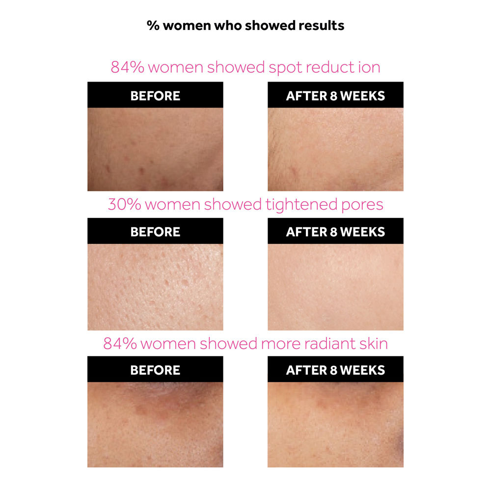 ponds flawless radiance derma mattifying day cream