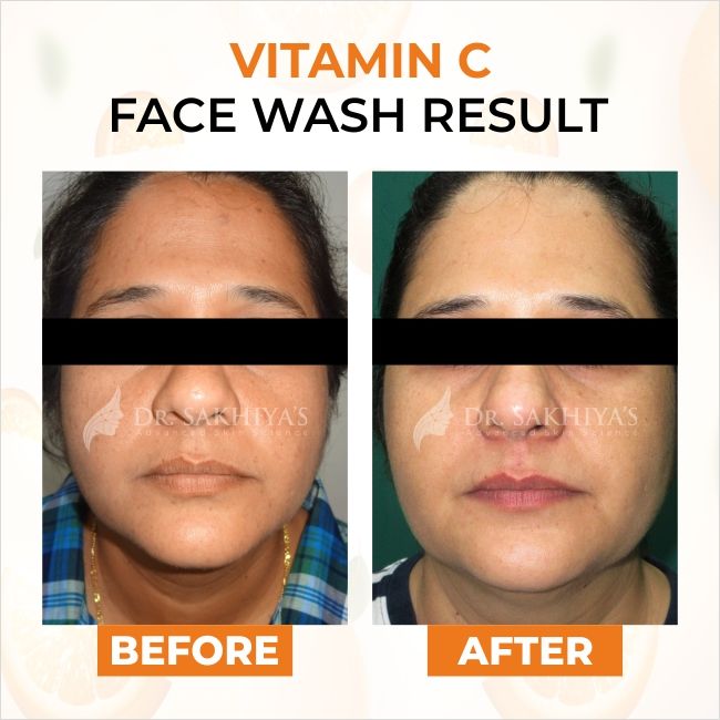 Buy Dr. Sakhiya Vit C Face Wash Online