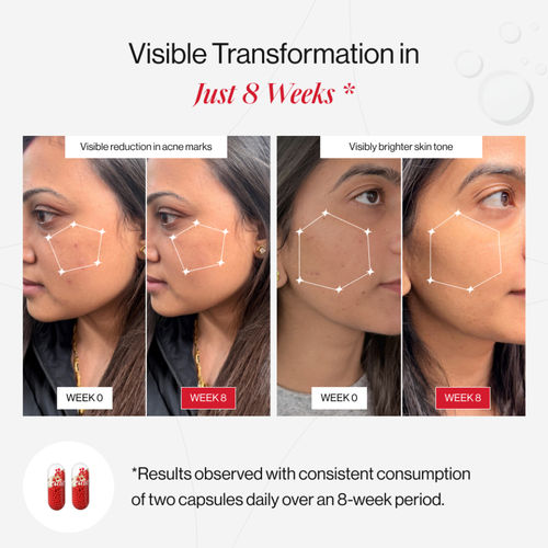 glutathione pills before after My 21 day oral glutathione results 🤞(Before & After) :  r/IndianSkincareAddicts