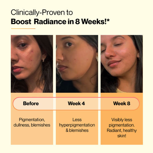 tenzero glutathione Glow up your skincare routine with TENZERO Glow Vita ✨🍊 Formulated with  Vitamin C, glutathione, and niacinamide to help brighten dull skin, improve  uneven tone, and leave your skin looking fresh and