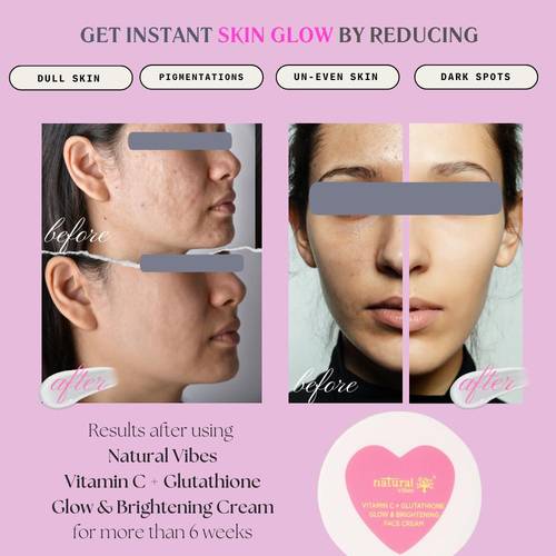 glutathione cream before after Natural Vibes Vitamin C + Glow & Brightening Face DOSAGE:20mg Gold Seal Supplements Reviews Facial Soap