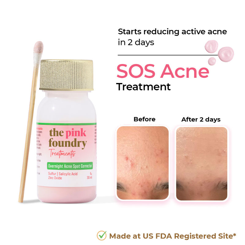 The Pink Foundry Overnight Acne Spot Corrector With Salicylic Acid For Active Acne, Blackheads & Whiteheads
