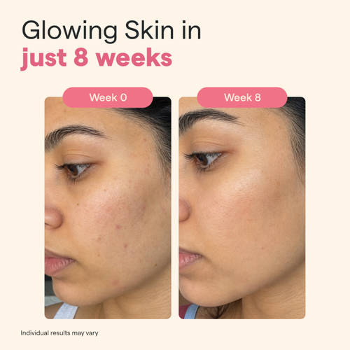 l glutathione pills before and after Buy The Good Bug Gluta Glow L-Glutathione Effervescent Tablets Size:120 Caps Windows Can Vitamin B12 help