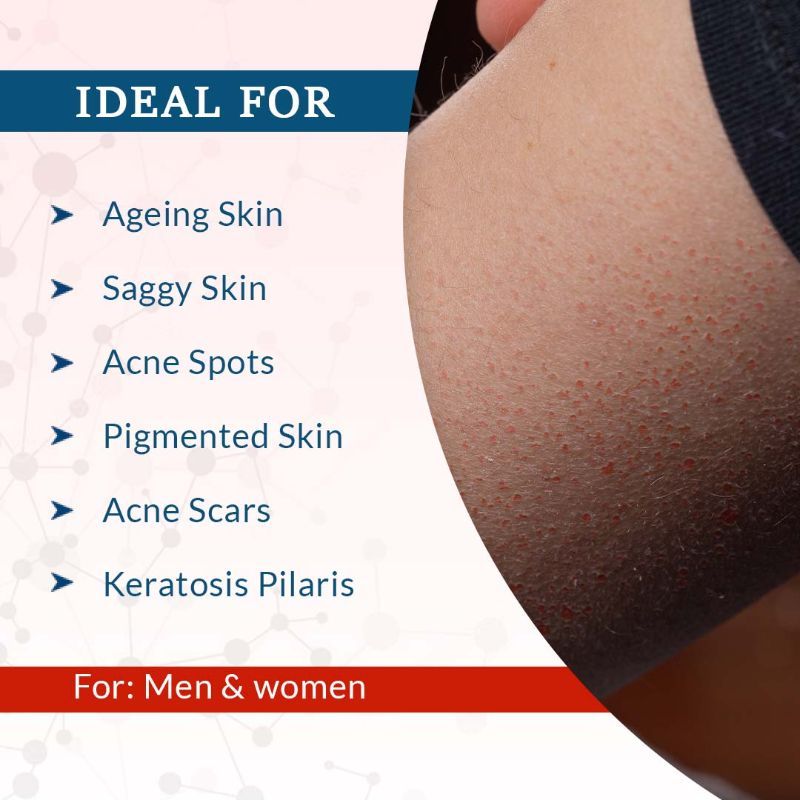 FCL Bio Retinol Body Lotion, For SkinAgeing, Keratosis Pilaris