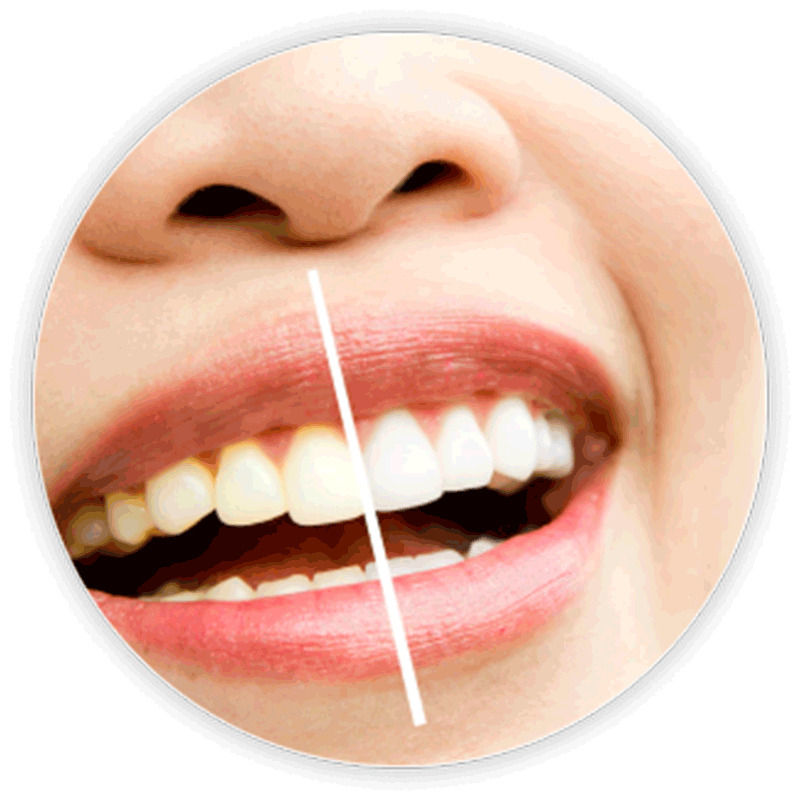 Bonayu Teeth Whitening Strips + Oral Breath Care Strips(mouth Wash