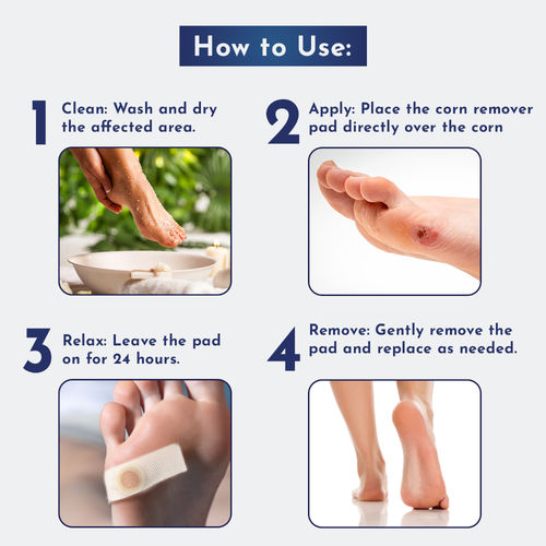 Buy Wipness Natural Foot Corn Removal Plaster 20 Strips Online
