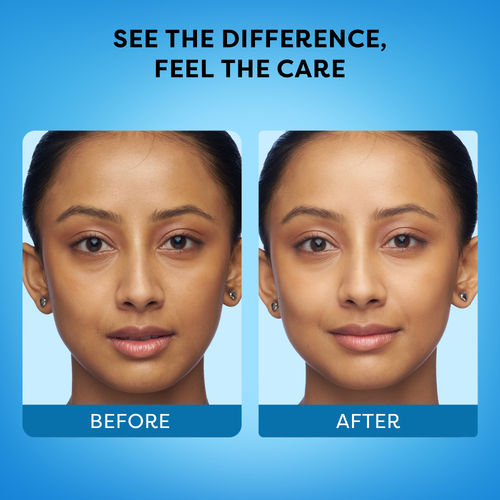 glutathione face before and after Vitamin C Serum with Glutathione, 4D Hyaluronic Acid & Aloe Vera – Lightweight Brightening & Hydrating Ampoule for Daily Skincare, Dark Spots, Sensitive Skin Friendly Glutathione Injections - Specials -