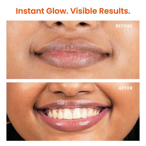 glutathione lip balm before and after results Foxtale Brightening with Peptides, Vitamin C & Hyaluronic Acid for Dry Lips & Pigmentation *ppm indicates parts per million Glutathione IV Drip Before and