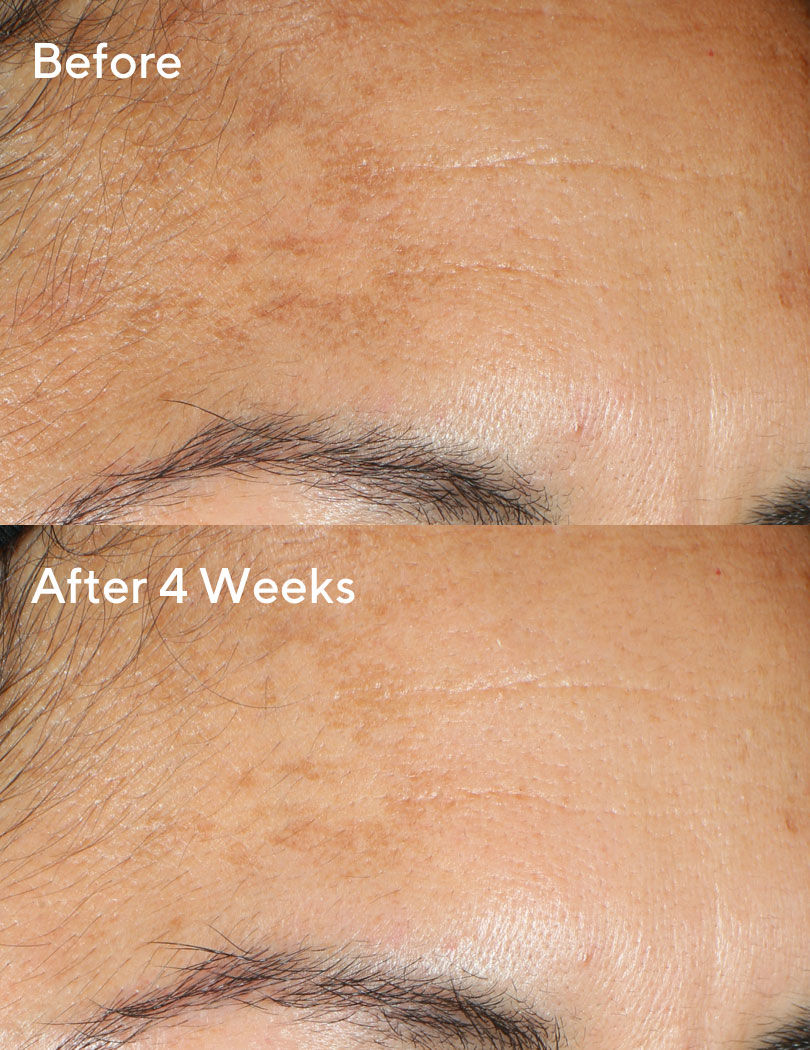 murad glycolic vitamin c serum