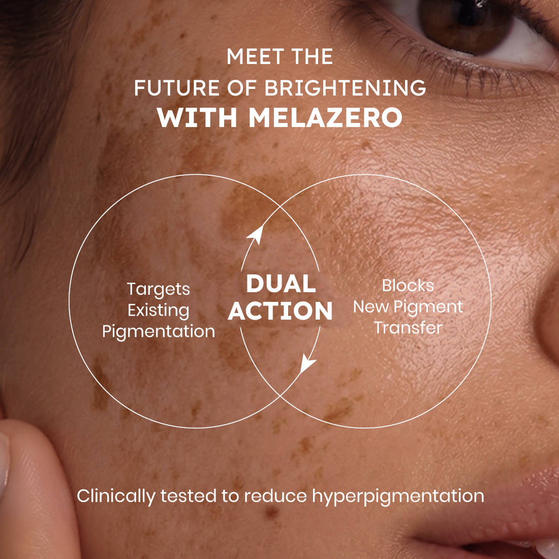 Buy Hyphen Melanoclear Brightening Moisturizer Online
