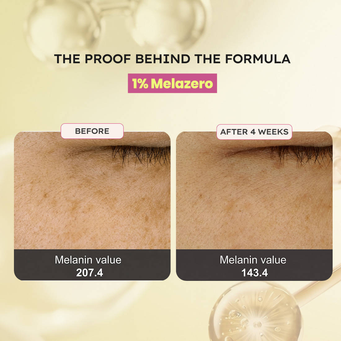 Buy Hyphen Melanoclear Brightening Moisturizer Online