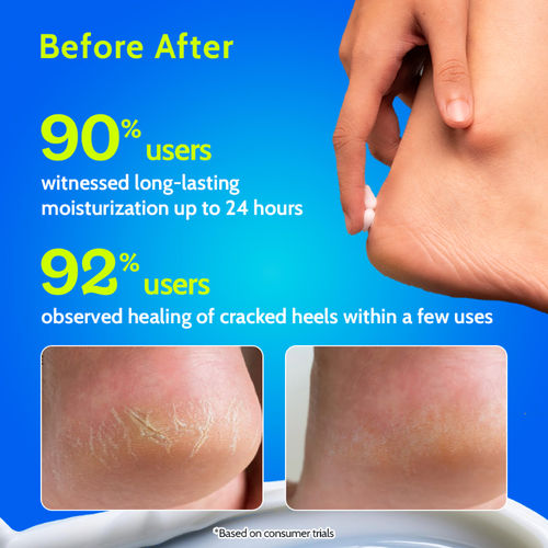 Buy Chemist At Play 10% Urea Foot Cream For Cracked Heels