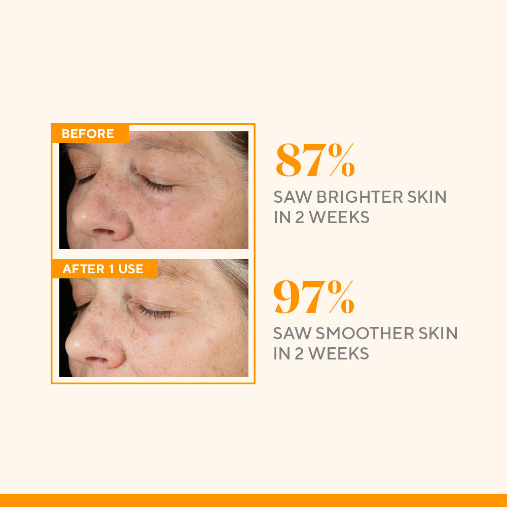 Murad Environmental Shield Vitamin C Triple Exfoliating Facial Buy