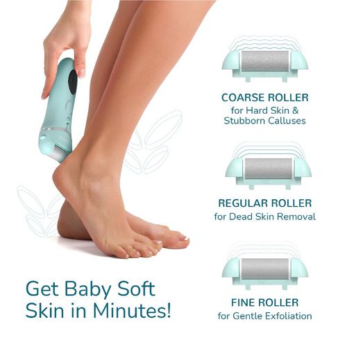 Buy Caresmith Bloom Rechargeable Callus Remover for Feet Pedicure