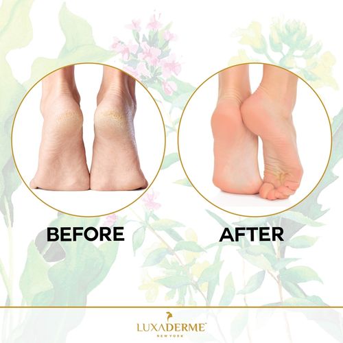Buy LuxaDerme Peeling Exfoliating Foot Mask Online