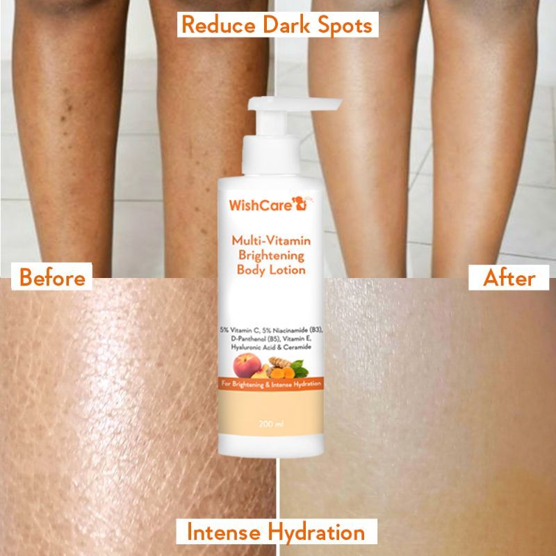 Wishcare MultiVitamin Brightening Body Lotion 5 Vitamin C, 5