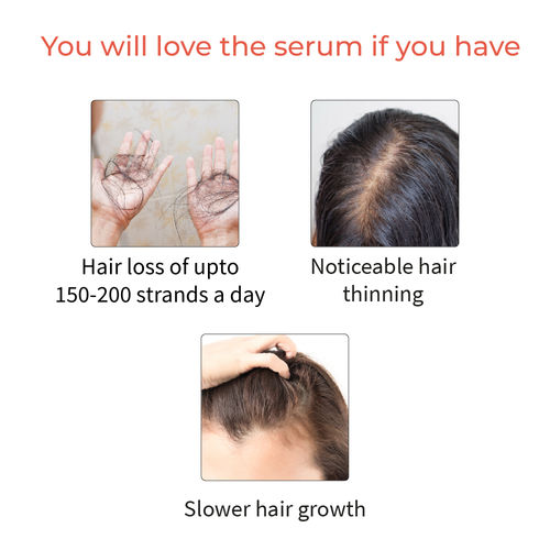 Vedix Hair Shampoo & Serum Combo - Normal/Oily Hair - Anti-Hairfall /Hair  Growth Combo: Buy Vedix Hair Shampoo & Serum Combo - Normal/Oily Hair -  Anti-Hairfall /Hair Growth Combo Online at Best