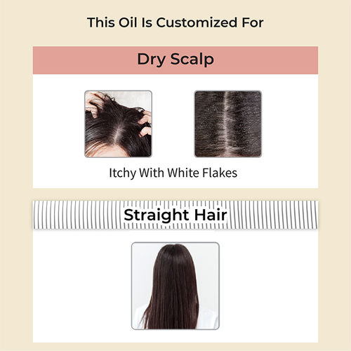 Vedix Hair Oil Dry Scalp & Straight Hair - Niryath Root Stimulating Hair Oil:  Buy Vedix Hair Oil Dry Scalp & Straight Hair - Niryath Root Stimulating Hair  Oil Online at Best