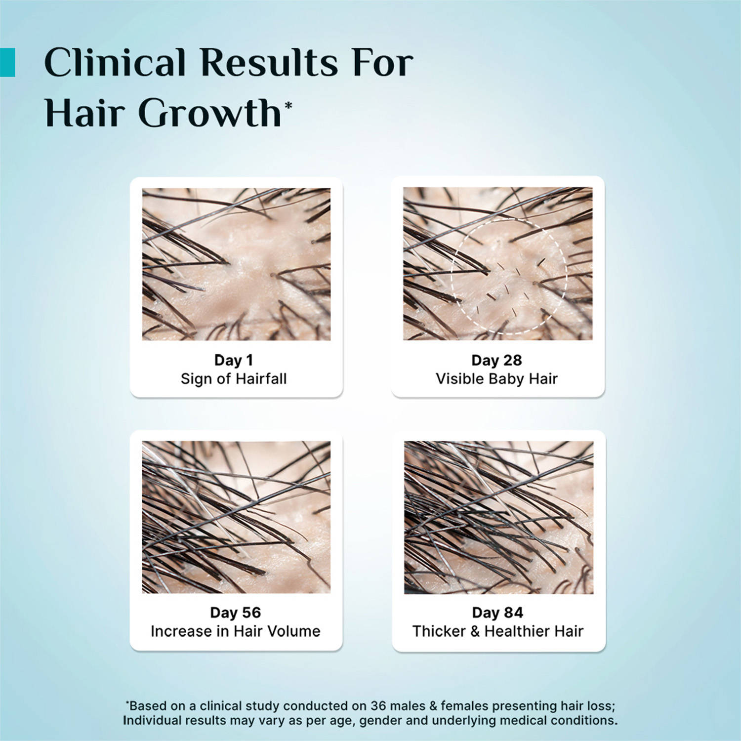 product image11