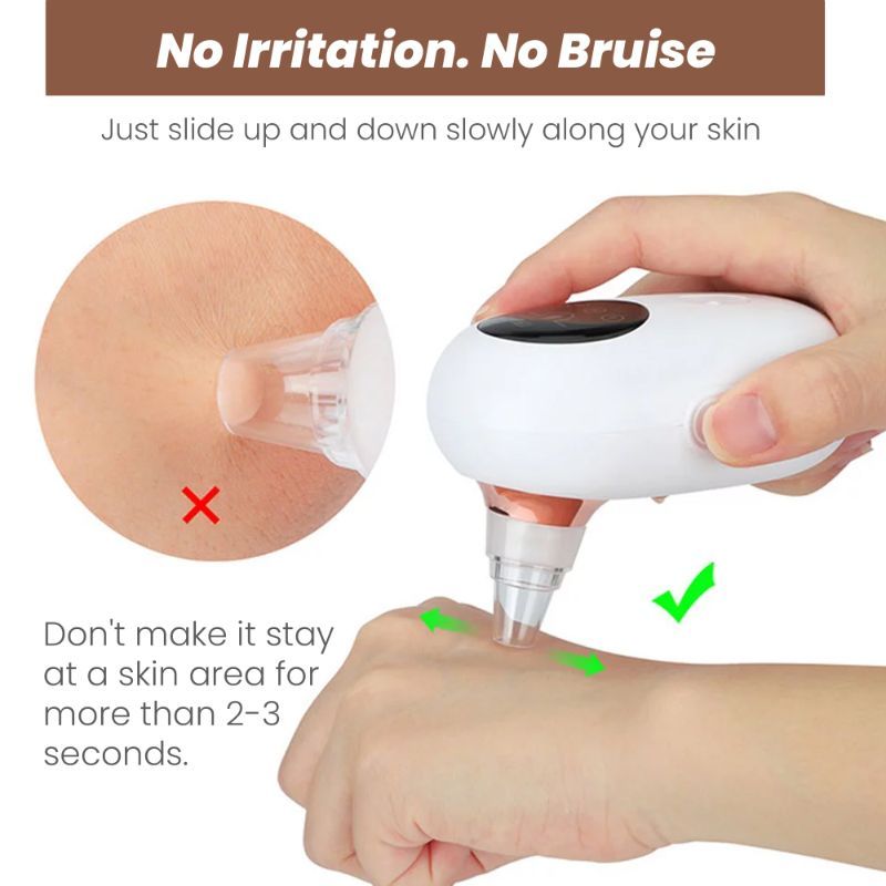 Winston Rechargeable Blackhead, Whitehead Remover Tool & Pore Cleaner