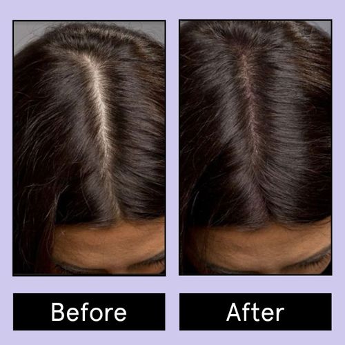 Be Bodywise 5000 Mcg Biotin Gummies For Healthy Hair With Added Zinc &  Multivitamins - 120 Day Pack: Buy Be Bodywise 5000 Mcg Biotin Gummies For  Healthy Hair With Added Zinc &