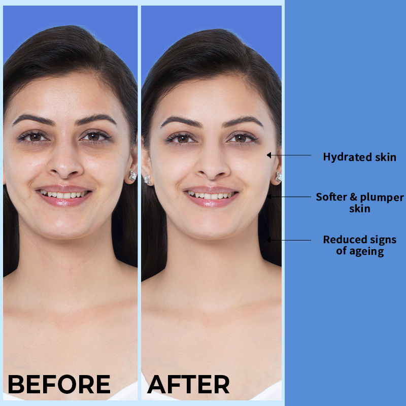 Nykaa SKINRX Hyaluronic Acid Hydra X Day Moisturizer With SPF 15 For