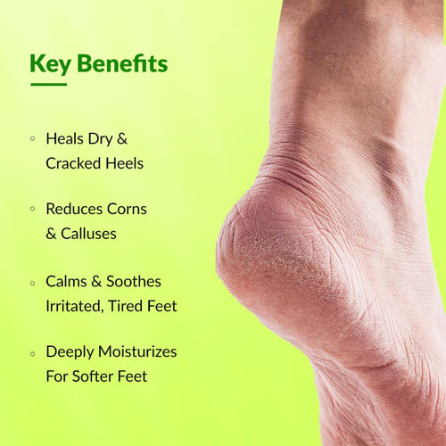Diabetic Foot Very Dry Cracked Heels Buy Diabetes And Dry Cracked Feet New  Arrivals