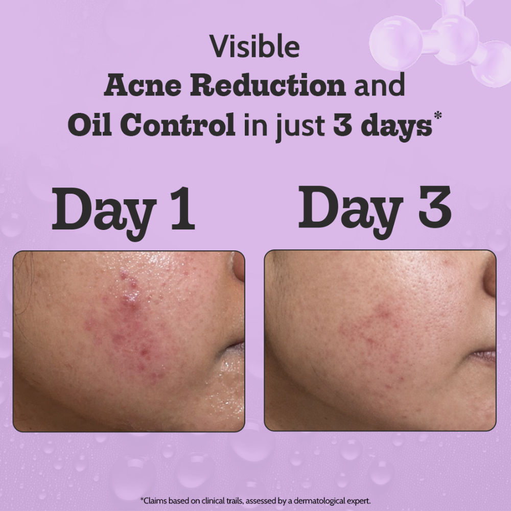 product image12