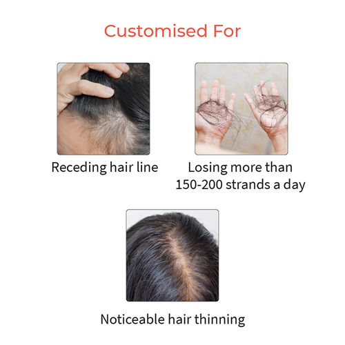 Vedix Hair Serum - Severe Hair Fall - Pragath Hair Serum: Buy Vedix Hair  Serum - Severe Hair Fall - Pragath Hair Serum Online at Best Price in India  | Nykaa