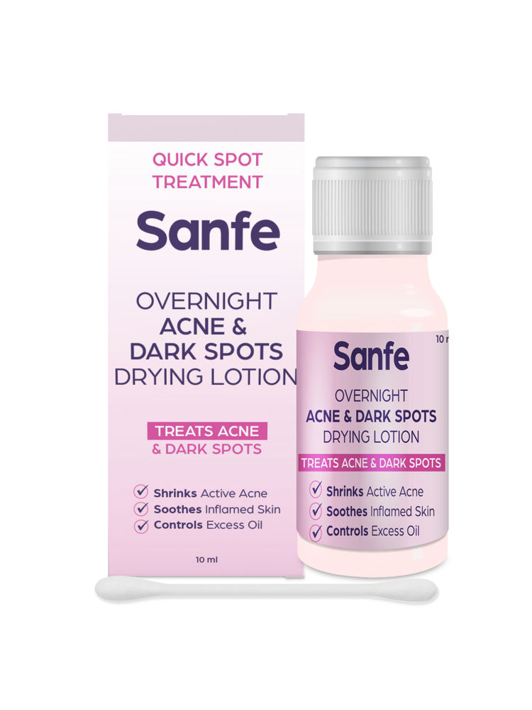 Sanfe Overnight Acne & Dark Spots Drying Lotion|For Acne, Dark Spots, Blackheads & Whiteheads, 10ml-picture-17