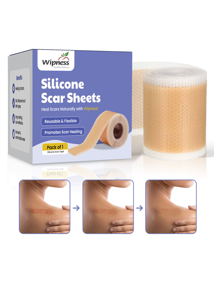 Wipness Silicone Scar Sheets 61 Inches (1.6 Meters)-image-13