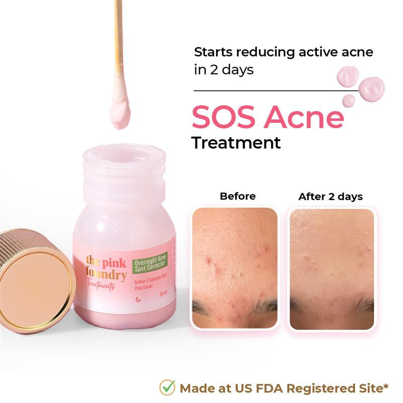 The Pink Foundry Acne Spot Corrector With Salicylic Acid For Active Acne, Blackheads & Whiteheads