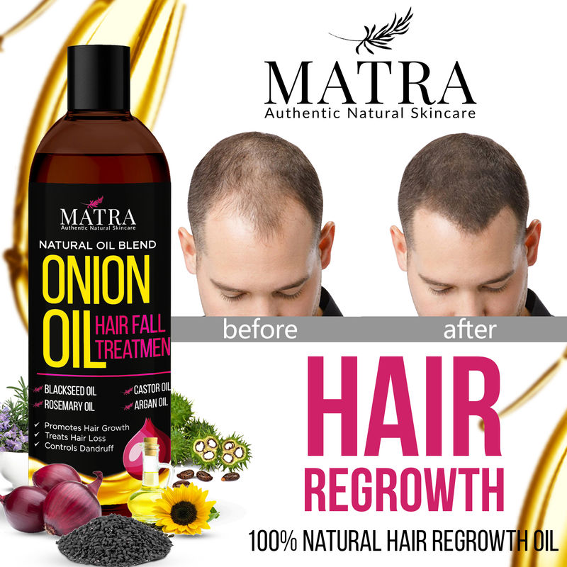 Matra Onion Hair Growth Oil For Hair Fall And Dandruff Treatment