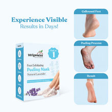 Wipness 100% Natural Foot Peeling & Exfoliating Foot Mask