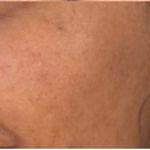 Plix Glutathione Skin Glow 15 Effervescent Tablet 500mg for Clear & Youthful Skin Reviews Online | Nykaa Plix Glutathione Skin Glow 15 Effervescent Tablet 500mg for Clear & Youthful Skin Reviews Online | Nykaa