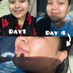 kojic glutathione soap benefits Kojic Acid 1% Soap with Glutathione Skin Lightening, Whitening, Brightening  Soap