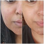 derma co glutathione soap Perricone MD Essential Fx Acyl-Glutathione Chia Facial Oil main image 1