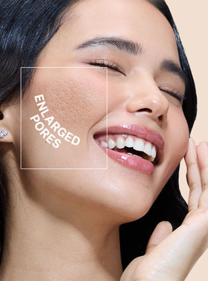 Enlarged Pores
